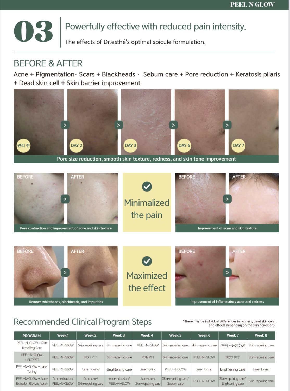 PEEL N GLOW  Pearl Program kit